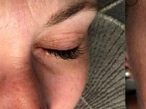 Wimpernbehandlung